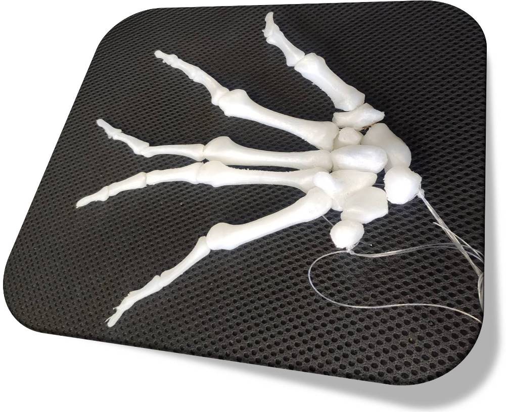 3D PRINTING OF ANATOMICAL MODELS